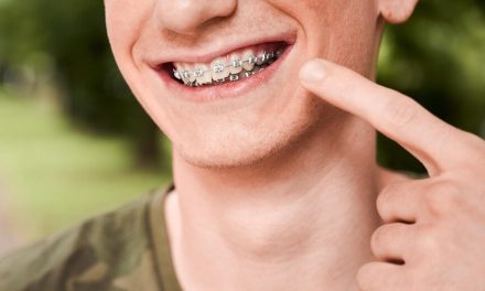 Cara Perawatan Gigi Memakai Berbehel Yang Harus Di Perhatikan