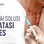 Tindakan Skleroterapi Prosedur Medis Untuk Mengatasi Varises